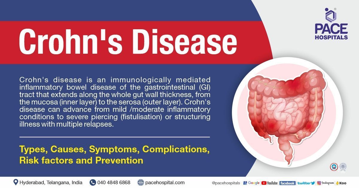 Crohn's Disease - Symptoms, Types, Causes, Prevalence, Complications & Prevention