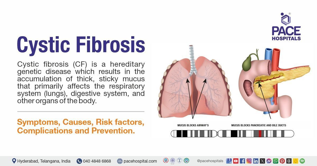 Cystic fibrosis symptoms & Causes | what is cystic fibrosis​ | cystic fibrosis​ treatment in India
