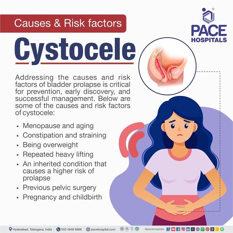 cystocele causes | what causes cystocele | Risk factors of Cystocele | Cystocele risk factors | Visual narrating the causes and Risk factors of Cystocele
