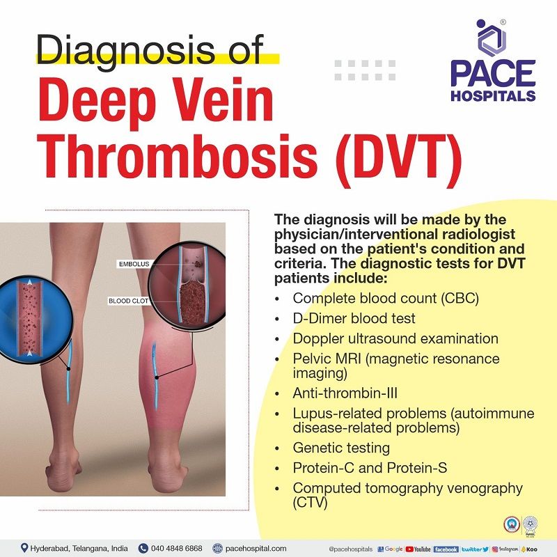 dvt diagnosis in hyderabad | dvt diagnostic test | deep vein thrombosis diagnosis | early diagnosis on deep vein thrombosis | diagnosis of dvt and pe in India