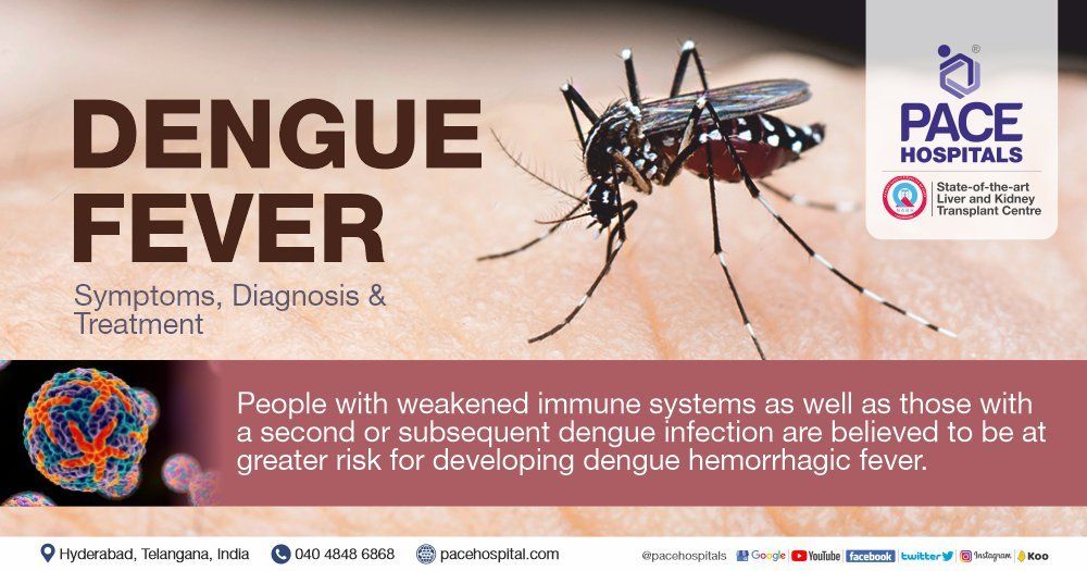 Dengue Fever Symptoms, Causes, Diagnosis and Treatment