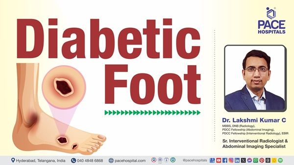 Dr. Lakshmi Kumar Chalamarla from PACE Hospitals explaining  everything about diabetic foot