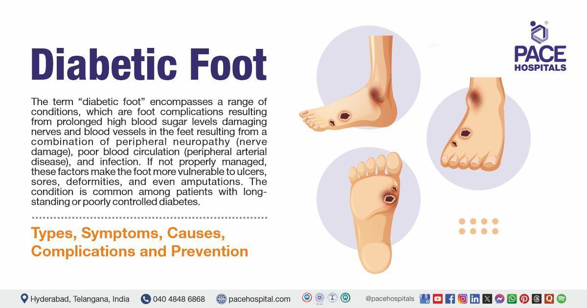 Diabetic foot symptoms & causes | Diabetic foot treatment in India | What is Diabetic foot