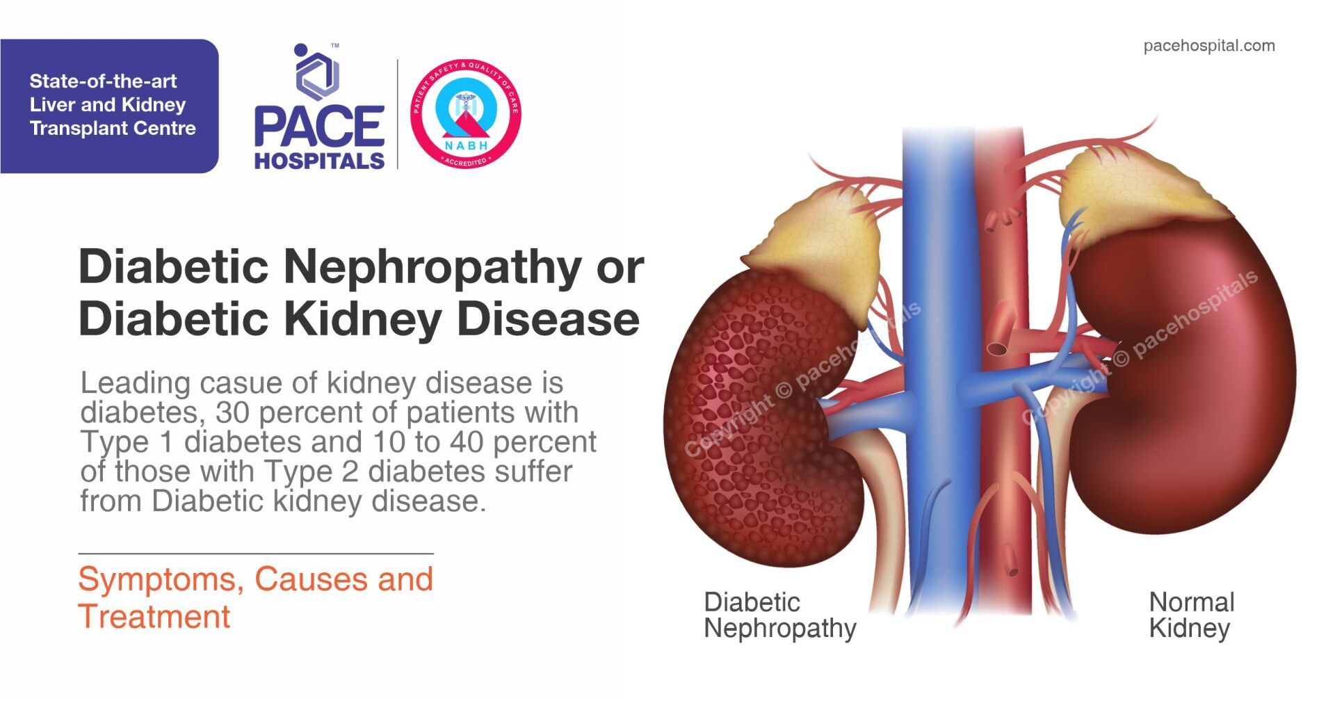 what is the first sign of diabetic nephropathy