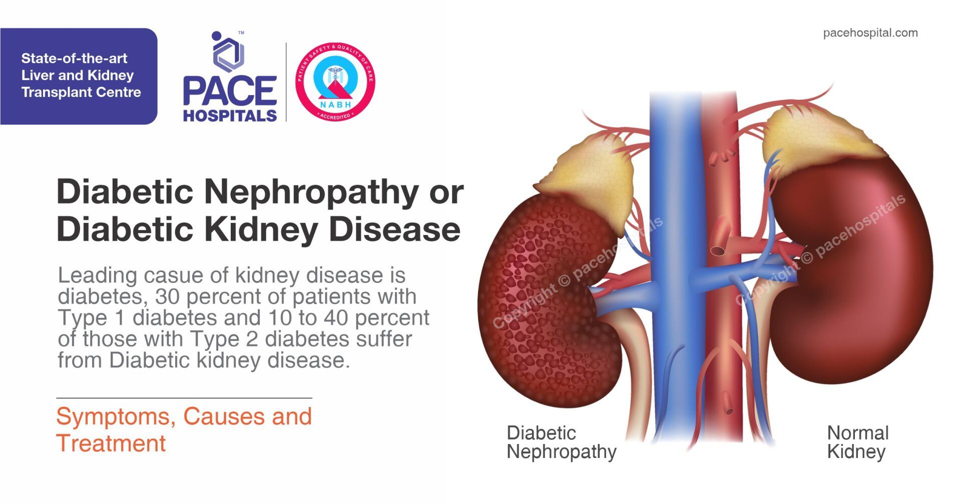 Diabetic Nephropathy Symptoms Causes Diagnosis And Treatment