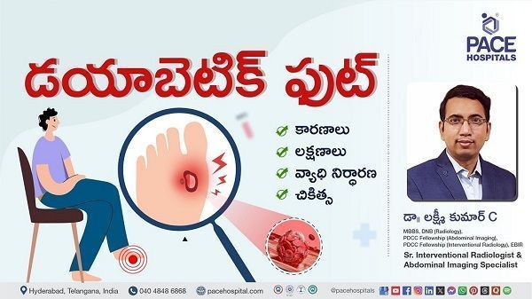 Diabetic Foot Causes, Symptoms & Treatment Explained by Dr. Lakshmi Kumar C from PACE Hospitals