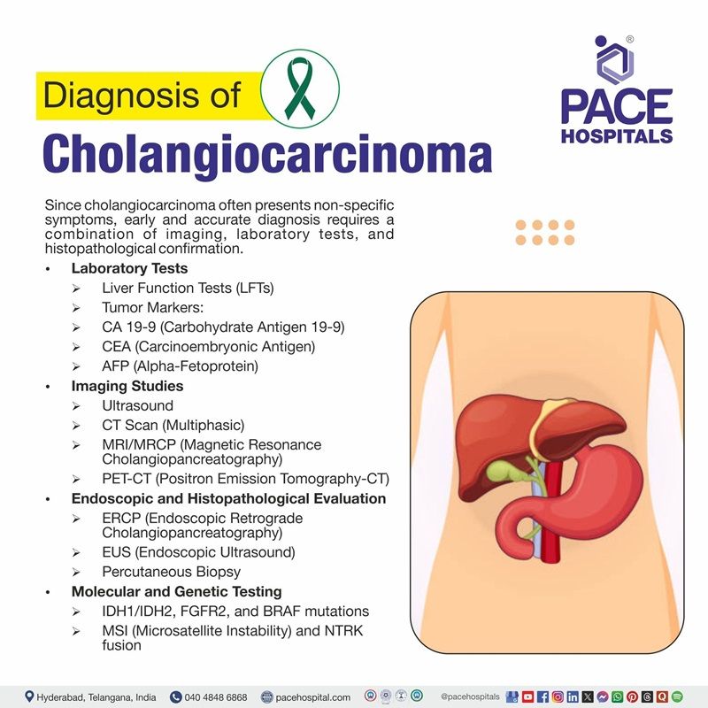 cholangiocarcinoma diagnosis​ | bile duct cancer diagnosis​ | Visual depicting the Diagnosis of Cholangiocarcinoma