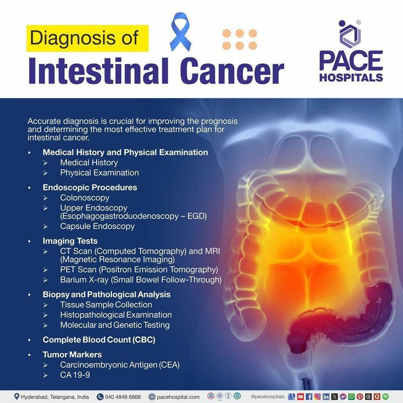 Intestinal cancer diagnosis | visual depicting the list of intestinal cancer diagnosis ways