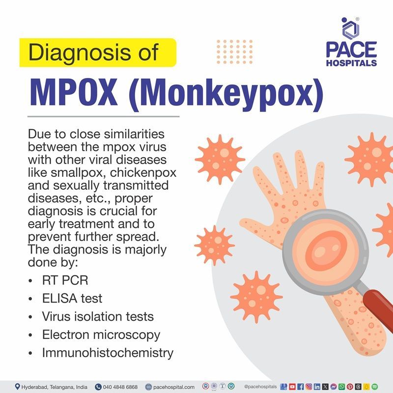 Mpox Diagnosis | Diagnosis of Mpox | Monkeypox diagnosis | Diagnosis of Monkeypox | visual depicting the Diagnosis of Monkeypox (Mpox)