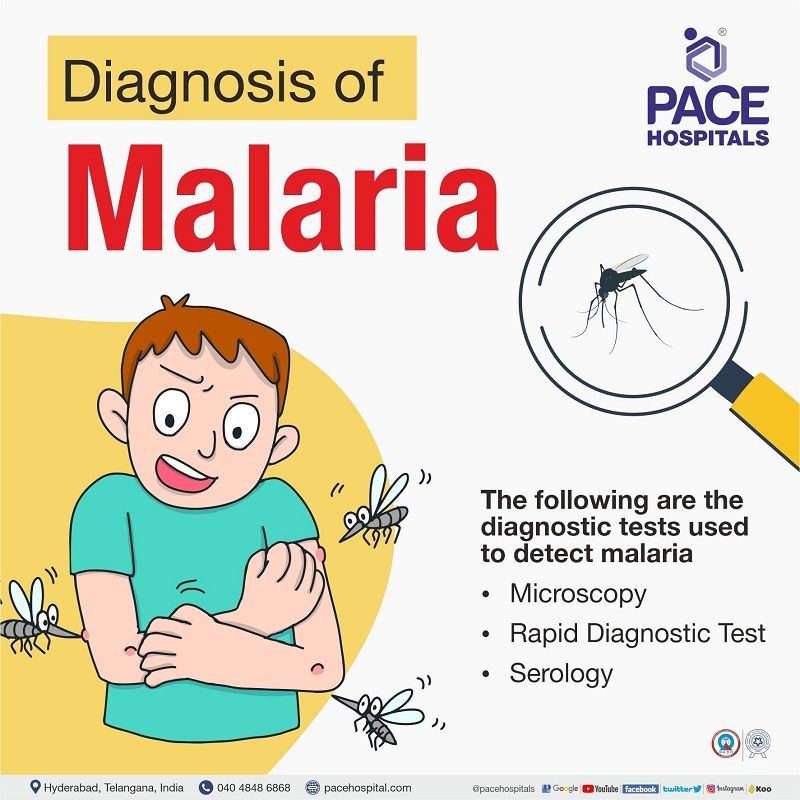 malaria diagnosis | diagnostic test for malaria | laboratory diagnosis of malaria disease | malaria diagnosis and treatment