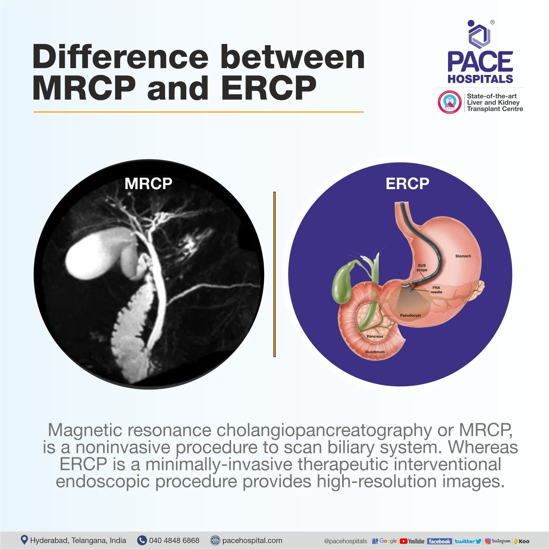 Difference between an MRCP and an ERCP | MRCP vs ERCP