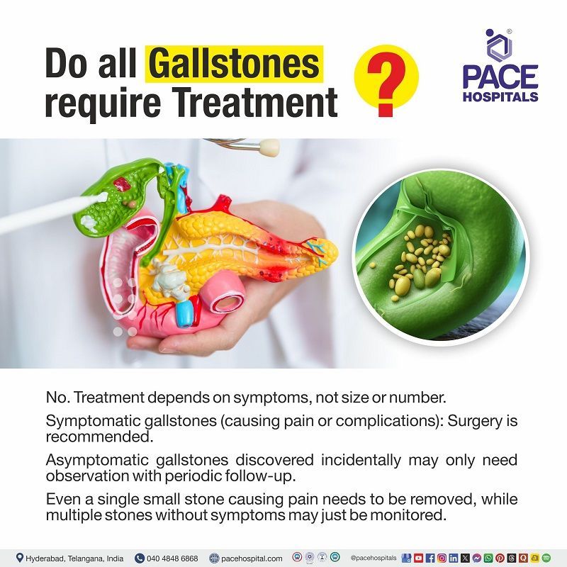 Gallstones that require Treatment All Gallstones requires Treatment