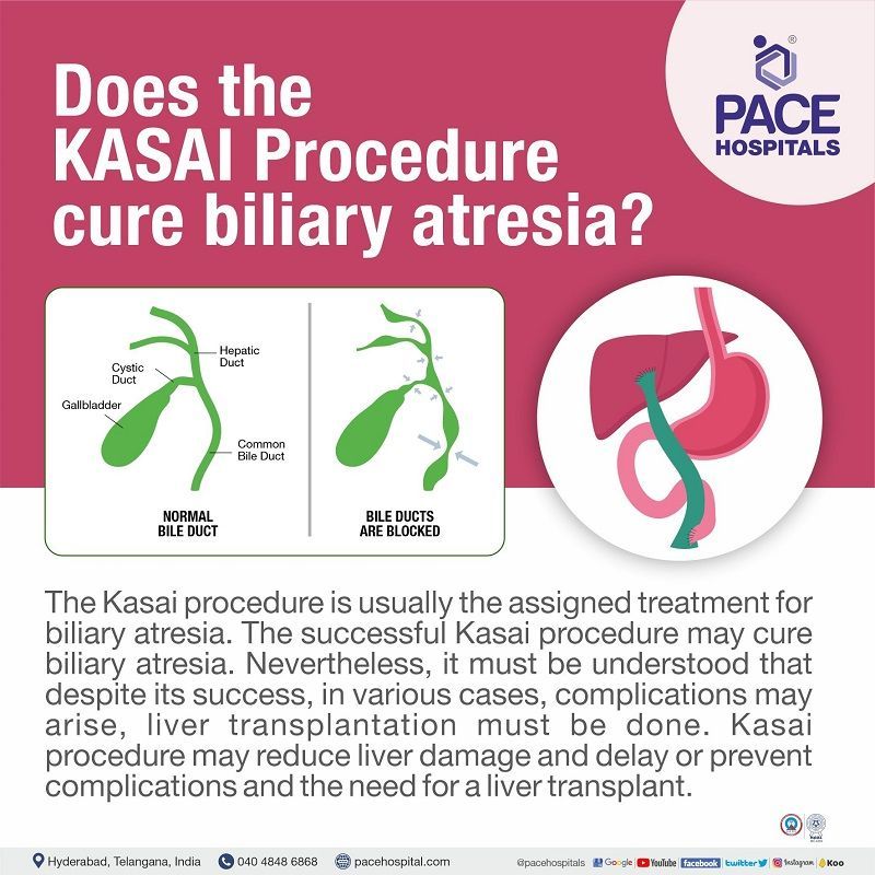 does the Kasai procedure cure biliary atresia | kasai procedure meaning in english | kasai procedure cost