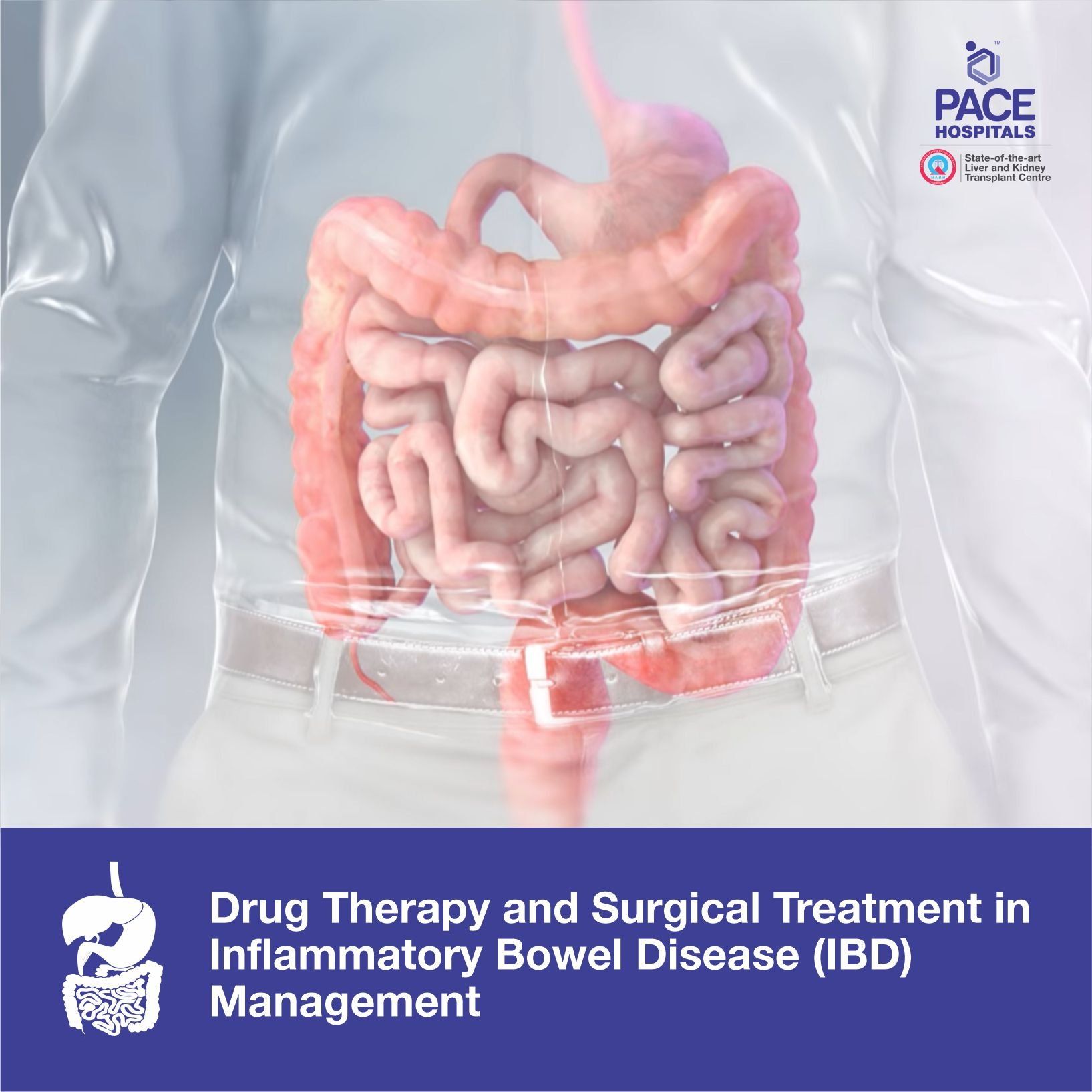 Drug Therapy and Surgical Treatment in Inflammatory Bowel Disease (Ulcerative colitis and Crohn's disease) Management