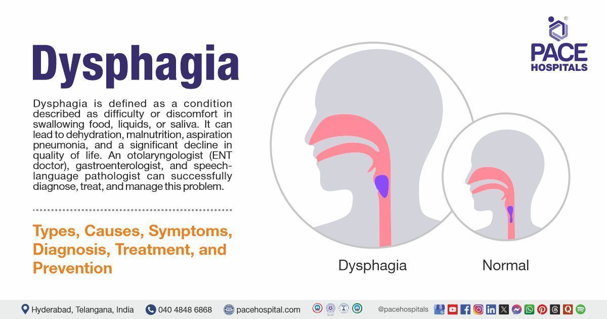 Dysphagia Causes, Symptoms & Types | Dysphagia Treatment in India | What is Dysphagia Meaning