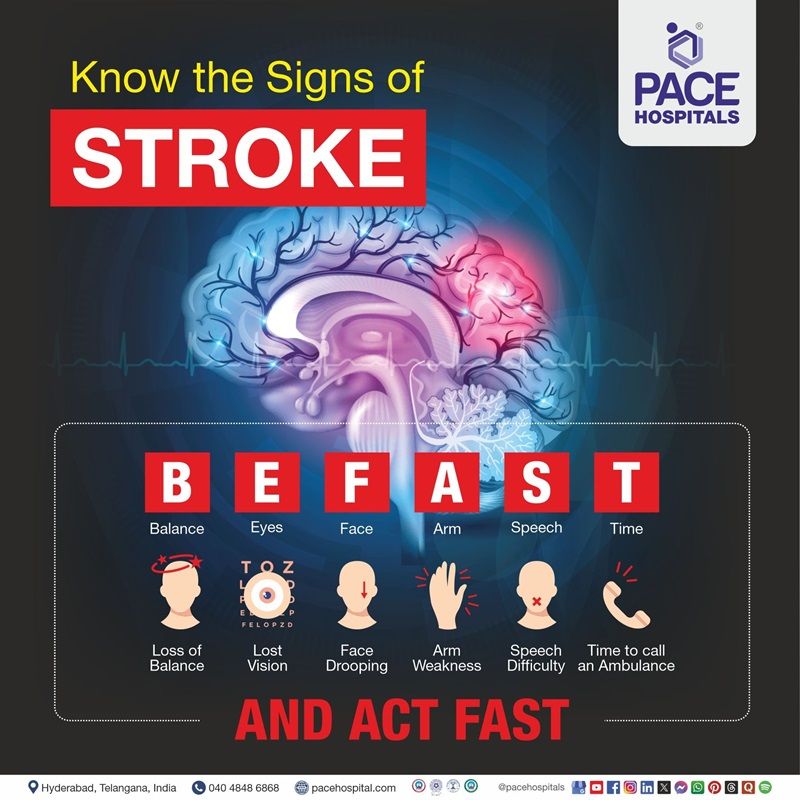 Early signs & symptoms of Brain Stroke | Best Treatment for Brain Stroke in Hyderabad, India | Treatment for Stroke in Brain