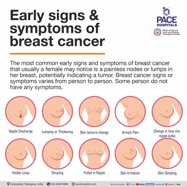 Breast Cancer Symptoms, Signs, Types, Risk Factors and Prevention