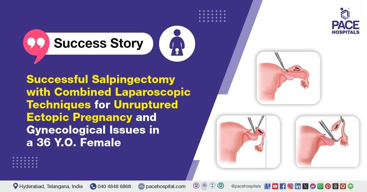 Laparoscopic salpingectomy to treat unruptured ectopic pregnancy in Hyderabad, India