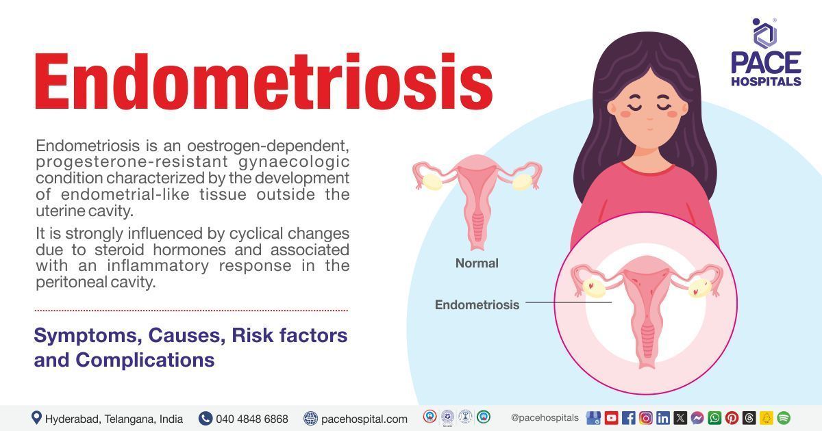 Endometriosis | Endometriosis symptoms | Endometriosis treatment | Endometriosis causes