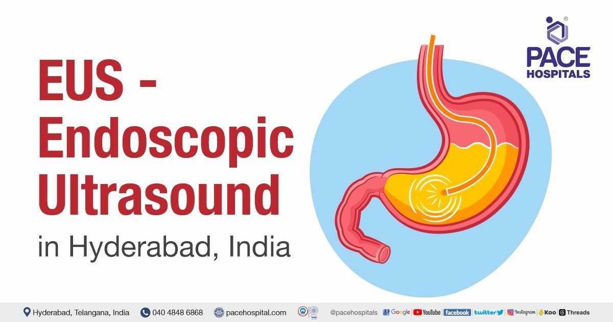 Endoscopic Ultrasound (EUS) in Hyderabad, India Uses & Cost