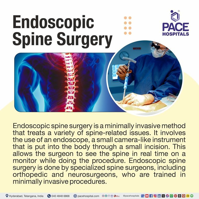 what is endoscopic spine surgery​ | endoscopic spine surgery meaning