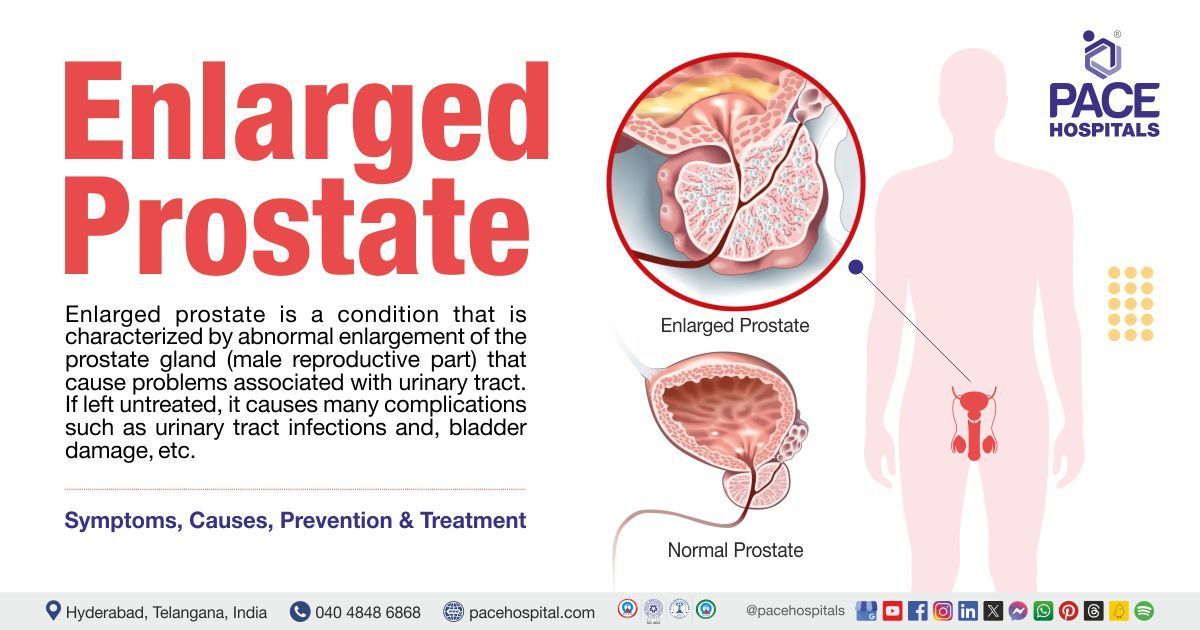 Enlarged prostate symptoms and treatment | BPH | Prostate gland enlargement treatment 
