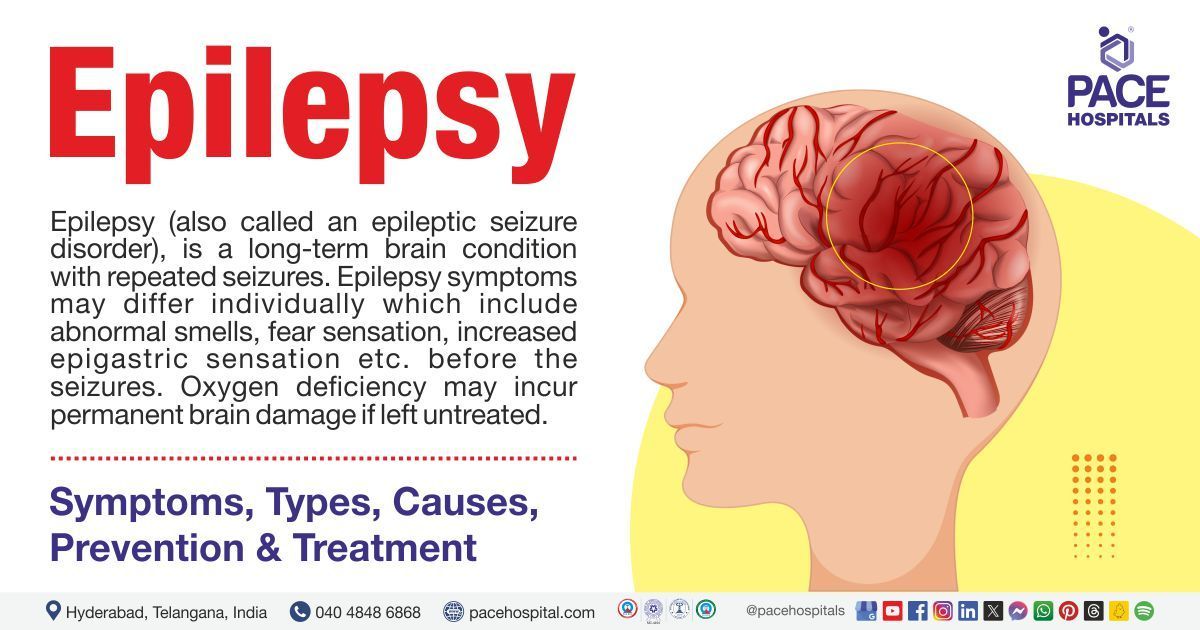 Explore everything about Epilepsy, its types, symptoms, causes, treatment & complications.


