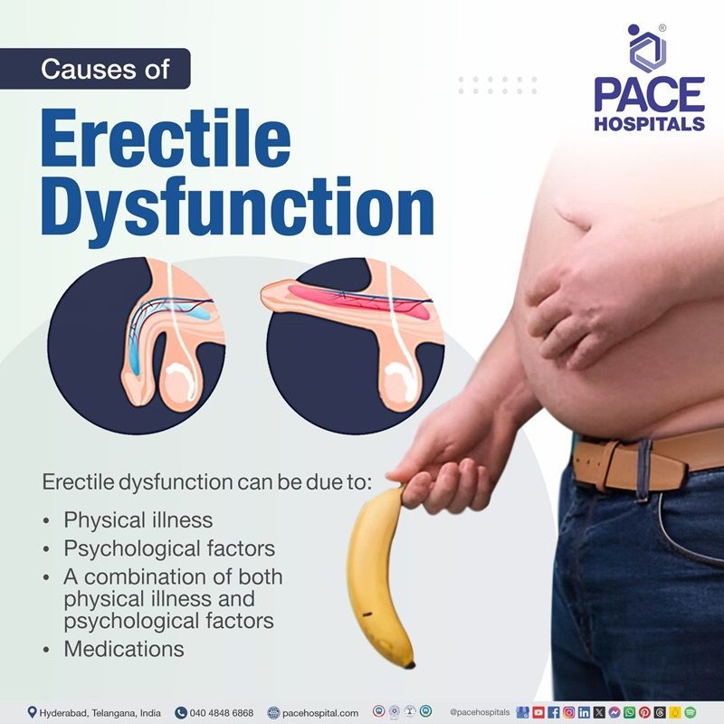 what is the main cause of erectile dysfunction | erectile dysfunction causes | what causes erectile dysfunction | Visual revealing the causes of erectile dysfunction