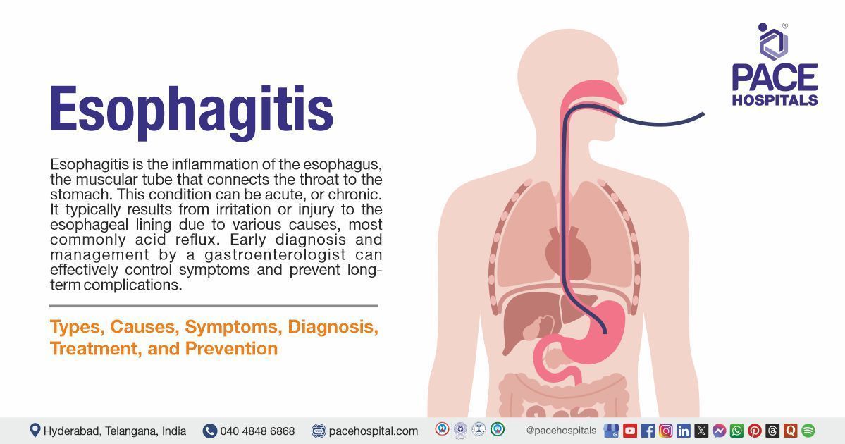 esophagitis symptoms | lifestyle changes to prevent esophagitis | Esophagitis treatment options