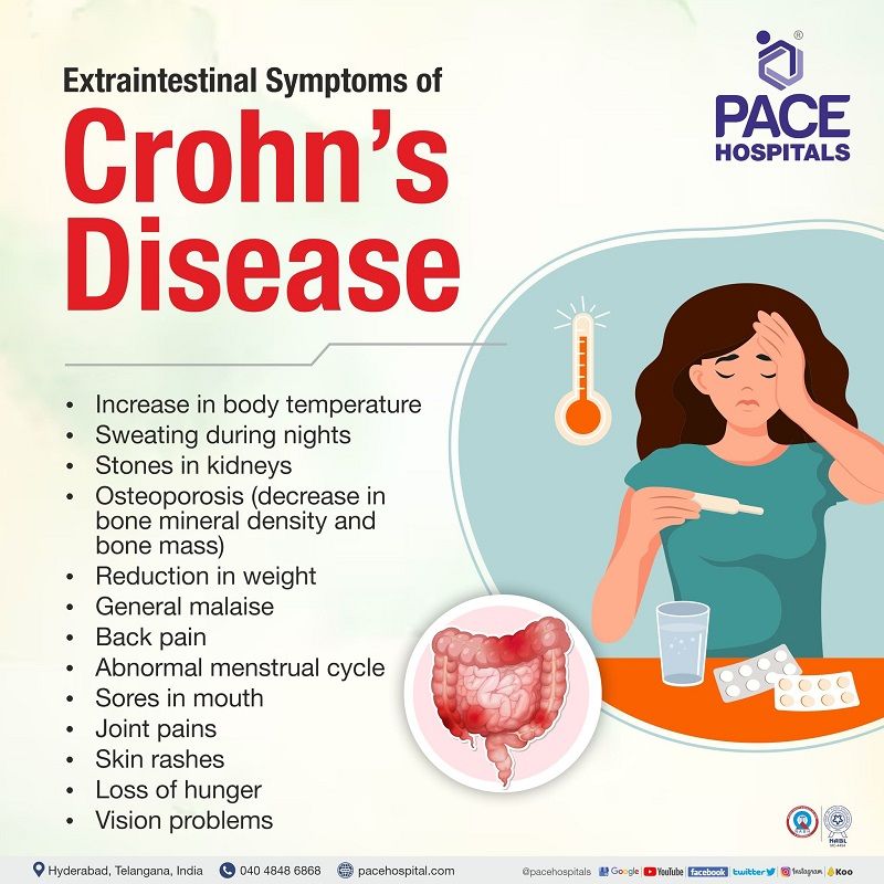 extraintestinal manifestations of crohn's disease | crohn's disease extraintestinal manifestations | intestinal fistula crohn's disease