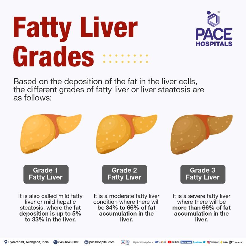 fatty liver grades explained | fatty liver grade 1 meaning | fatty liver grade 2 means | fatty liver grade 3 with hepatomegaly