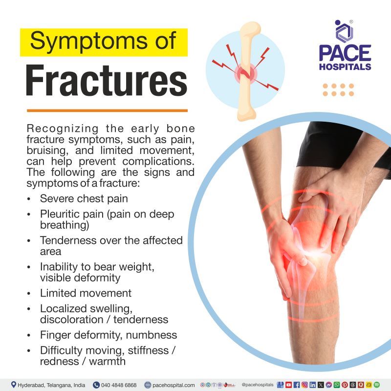 Fracture Symptoms Fracture symptoms | Bone fracture symptoms