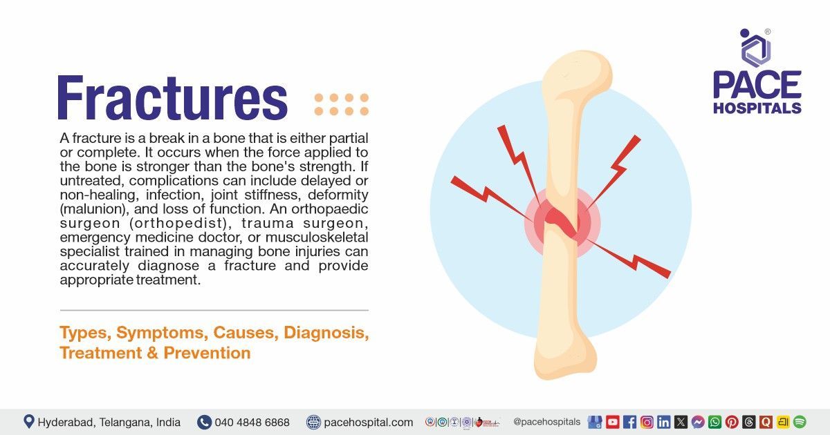 Fractures Symptoms, Causes, Types, Diagnosis and Treatment | Bone Fracture | What is a Fracture
