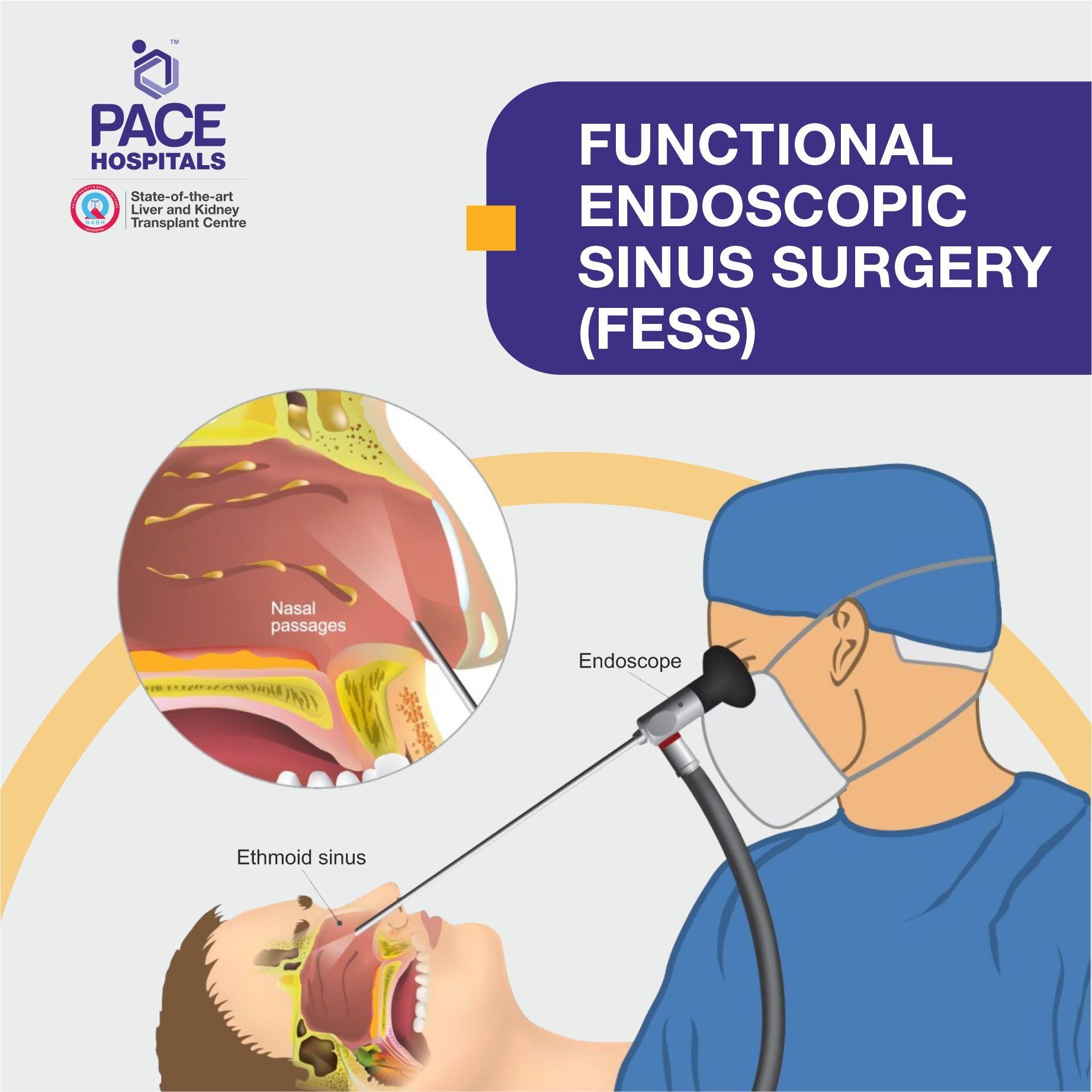 Functional endoscopic sinus surgery FESS in Hyderabad, Telangana, India
