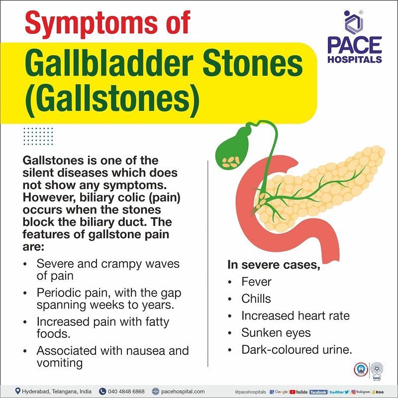 Gallstones, Gallbladder Stones – Symptoms, Causes, Complications