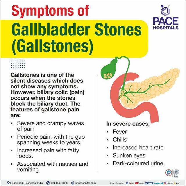 gallbladder pain location