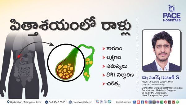 Gallbladder Stones Causes, Symptoms and Treatment Explained by Dr Suresh Kumar from PACE Hospitals.