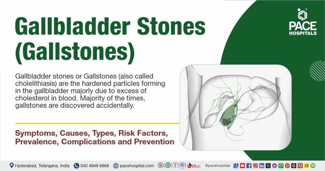 Gallstones, Gallbladder Stones – Symptoms, Causes, Complications