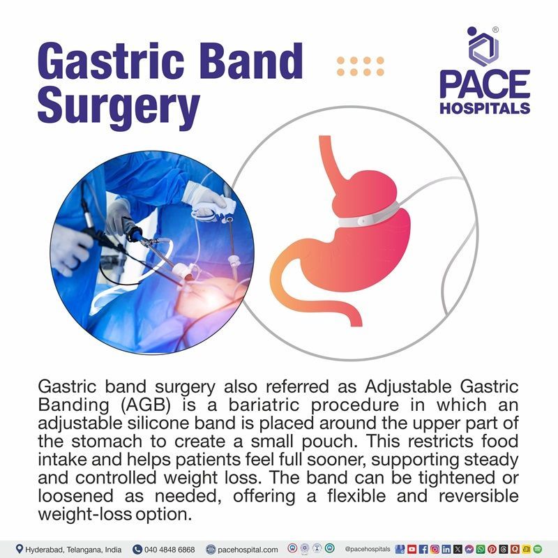 What is lap band surgery | adjustable gastric band surgery
