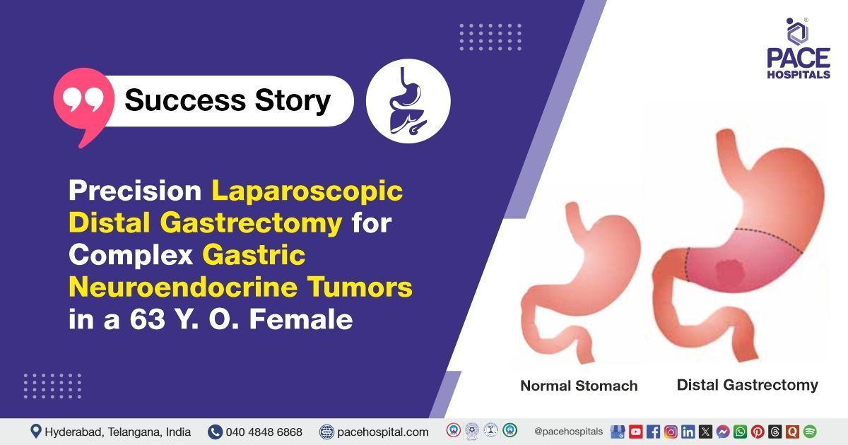 Case study of a 63-year-old patient with gastric neuroendocrine tumors treated at PACE Hospitals