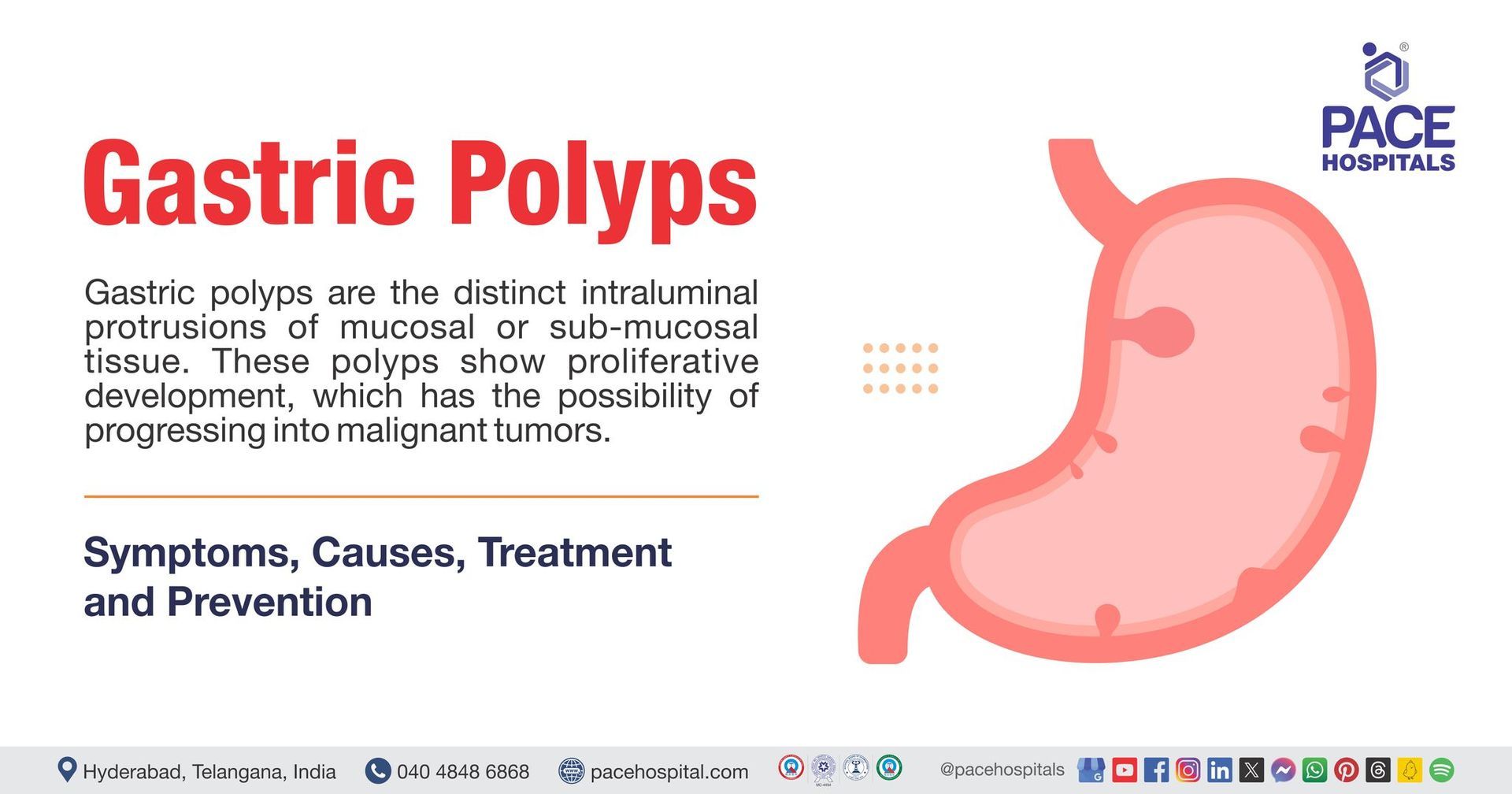 Gastric Polyps Symptoms and Causes | Gastric Polyp treatment in India | What is gastric polyp