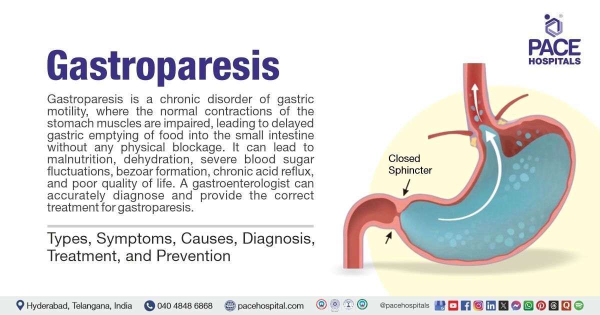 Gastroparesis Symptoms and Causes | Gastroparesis Prevention | Gastroparesis Treatment in India