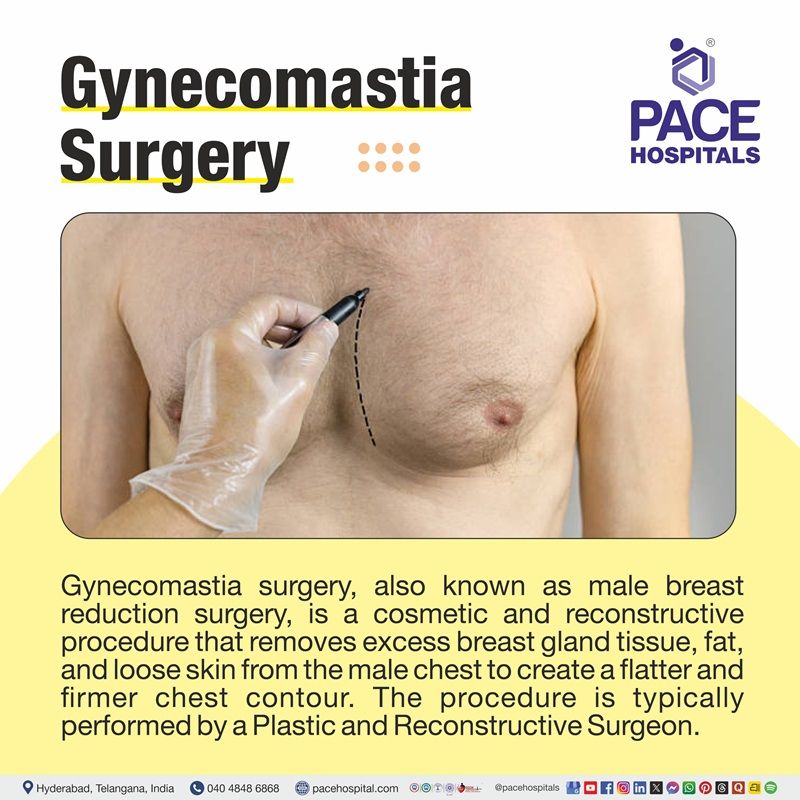 Gynecomastia surgery | what is gynecomastia | Male breast reduction surgery