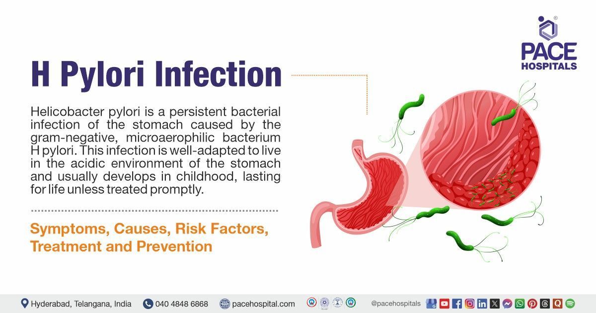 Helicobacter Pylori - Symptoms & Causes | H. Pylori Treatment in India | h pylori test