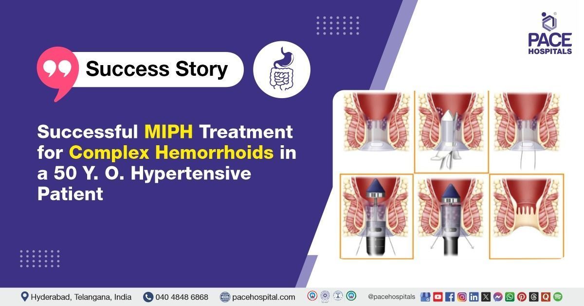 Case study of a 50-year-old hypertensive male treated for hemorrhoids at PACE Hospitals, Hyderabad.
