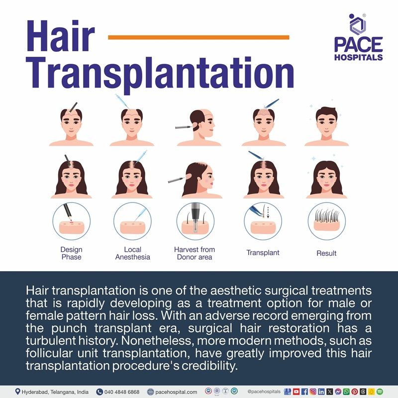 Best Hospital for hair transplant in Hyderabad India | hair transplant surgery hospital in Hyderabad | hair transplant near me | hair transplant cost in Hyderabad