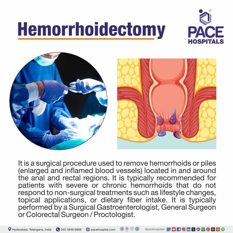 Hemorrhoidectomy definition | hemorrhoidectomy Meaning | What is hemorrhoidectomy