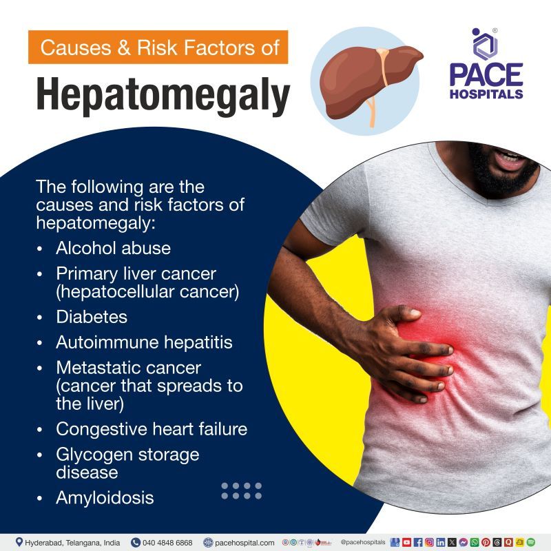 Hepatomegaly Causes | Risk Factors of Hepatomegaly | Causes of Hepatomegaly