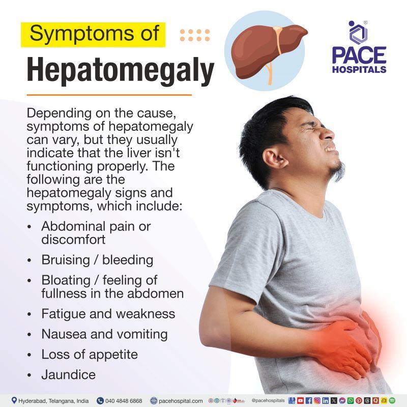 Hepatomegaly Symptoms | Hepatomegaly signs and symptoms | Mild hepatomegaly symptoms