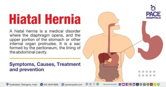 Hiatal Hernia - Symptoms, Types, Causes, Treatment and Prevention